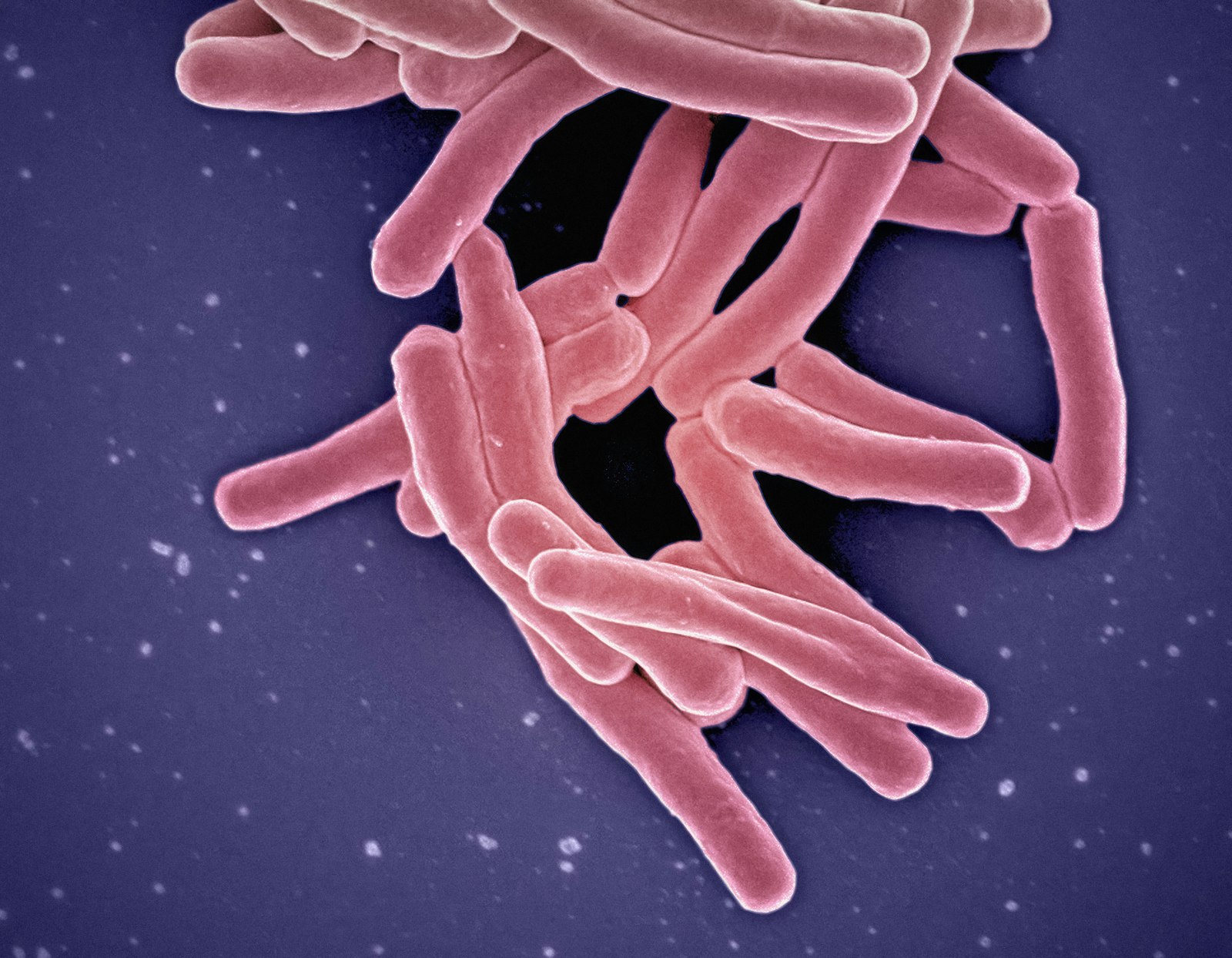 Giornata mondiale della tubercolosi